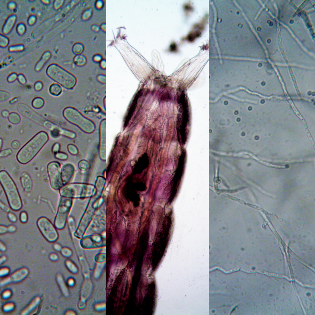 Good Microbes vs Bad Microbes